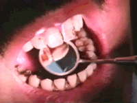 Gif animé bouche dentiste